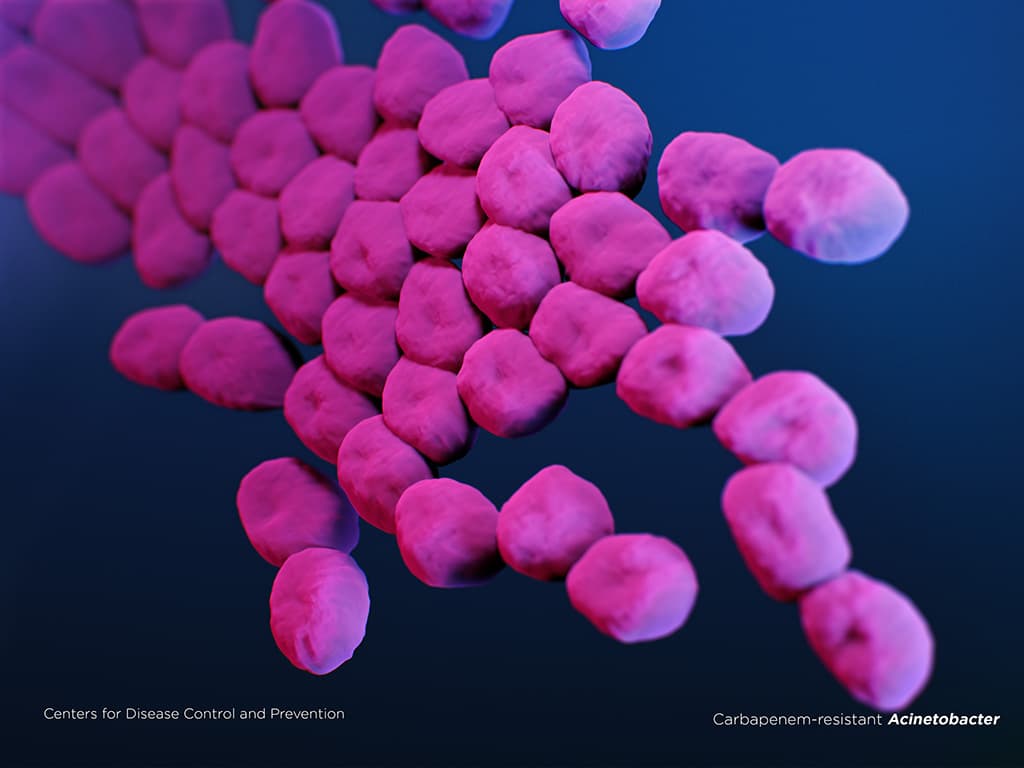 Illustration of Carbapenem-resistant Acinetobacter