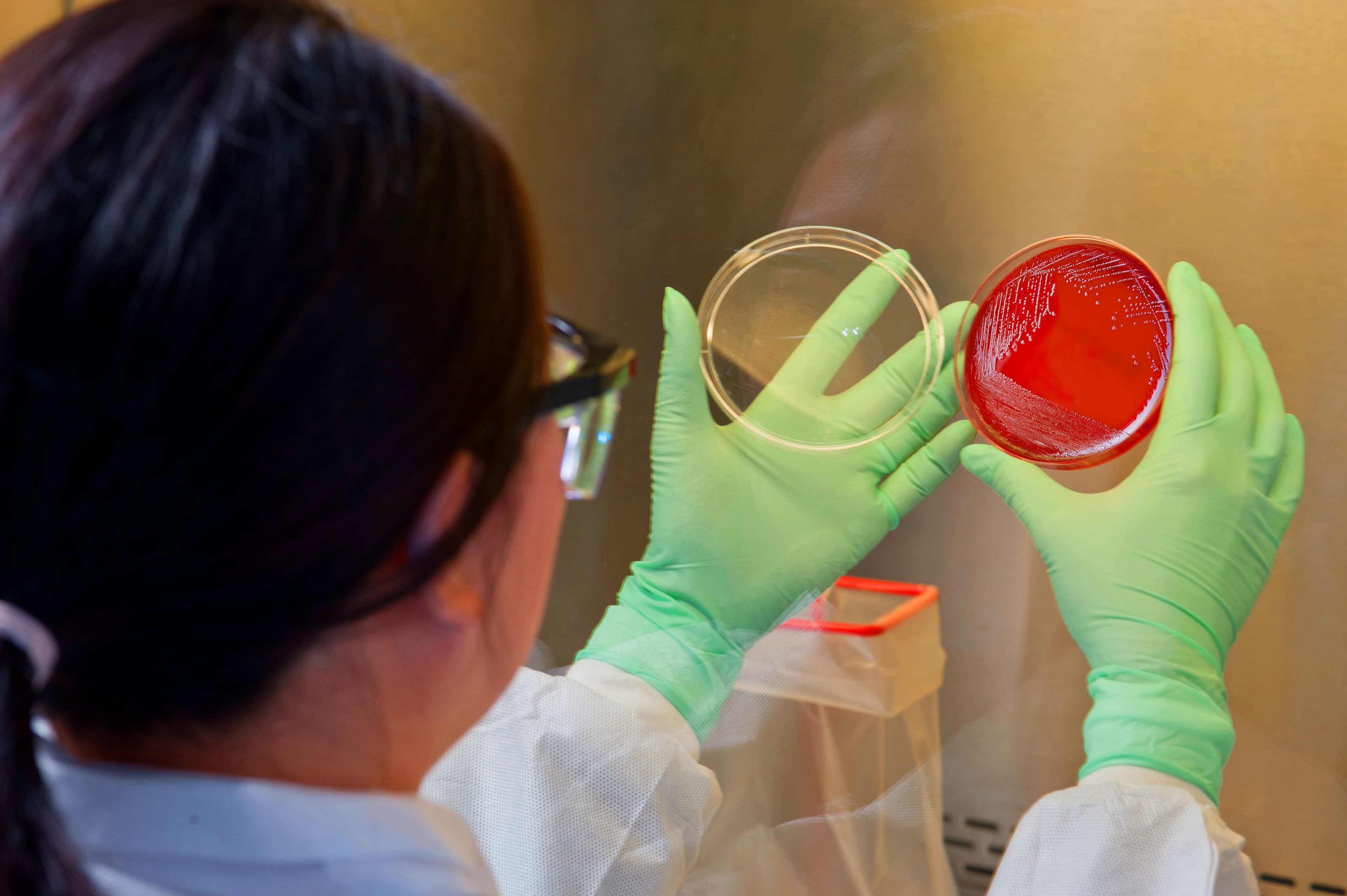 A laboratorian looks at streaks of bacteria growing in a petri dish.