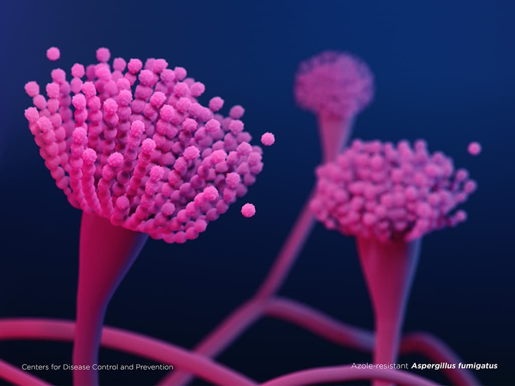 Azole-resistant Aspergillus fumigatus