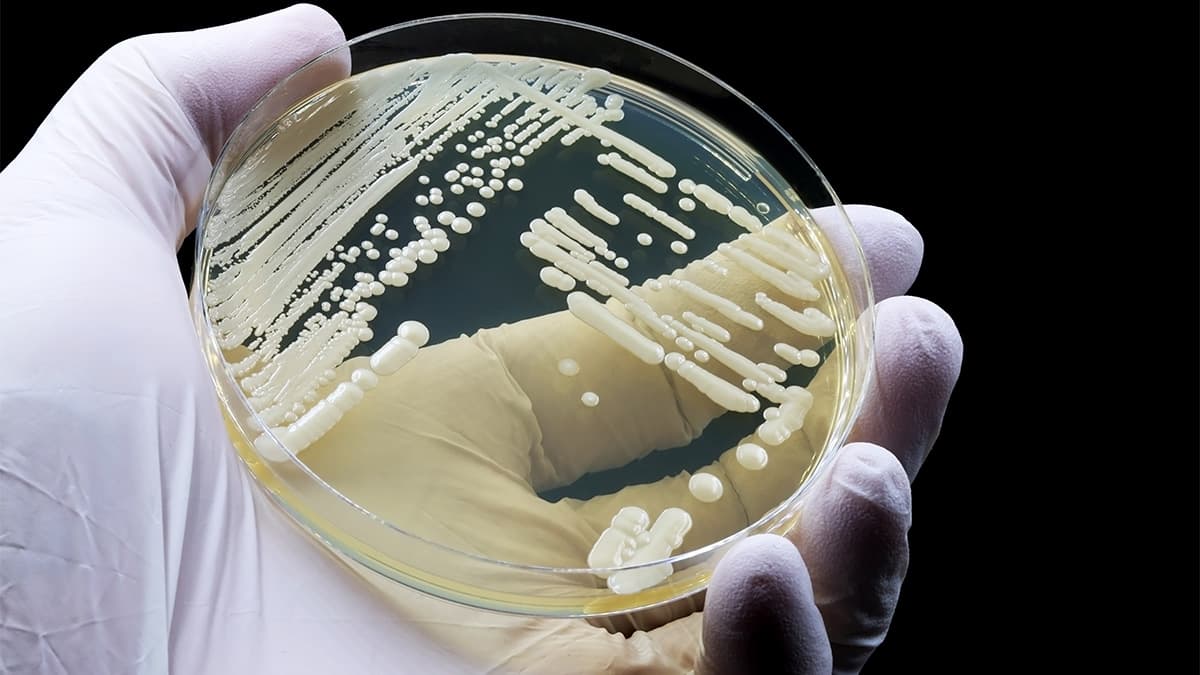Gloved hands holding a clear agar test plate showing a white culture of yeast (fungus).