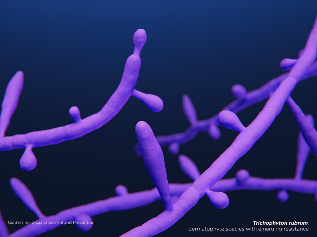 Drug-resistant dermatophytes