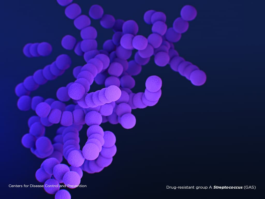 Illustration of Drug-resistant group A Streptococcus