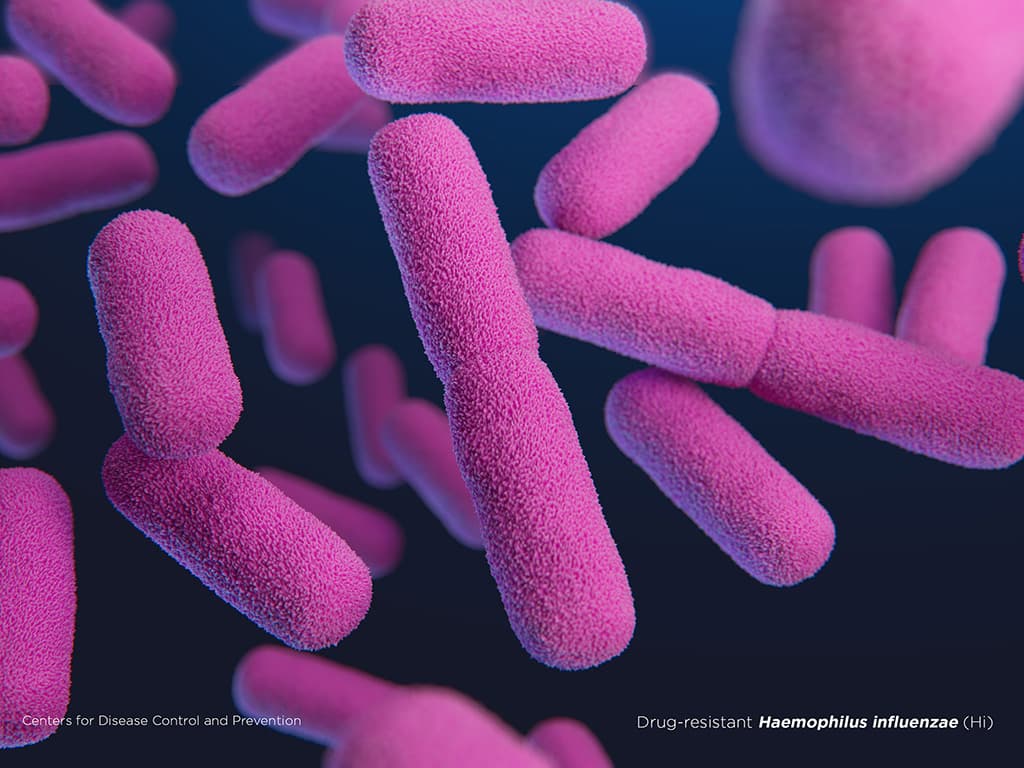 Drug-resistant Haemophilus influenzae bacteria