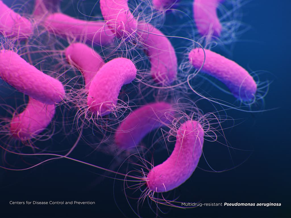 Illustration of Multidrug-resistant Pseudomonas aeruginosa