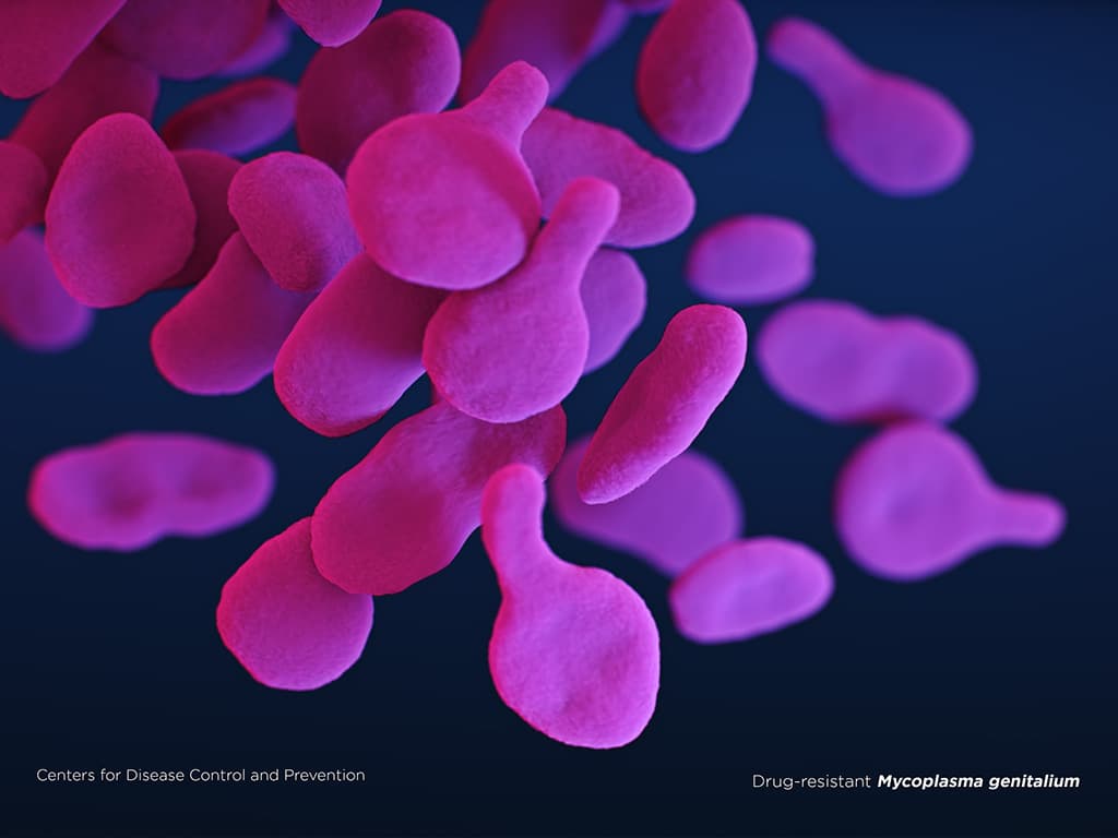 Drug-resistant Mycoplasma genitalium bacteria