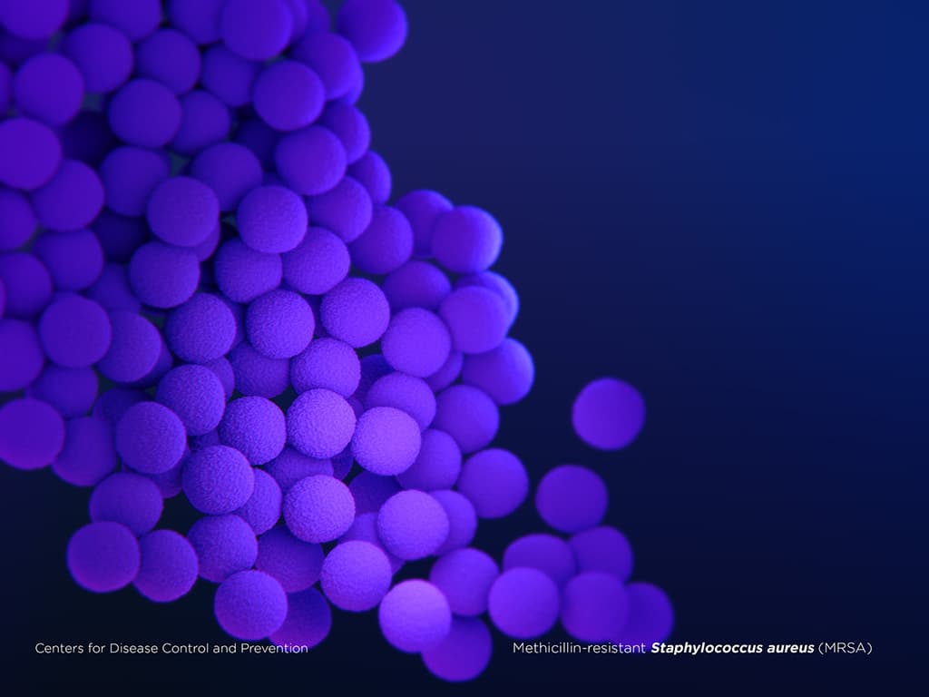 Illustration of Methicillin-resistant Staphylococcus aureus