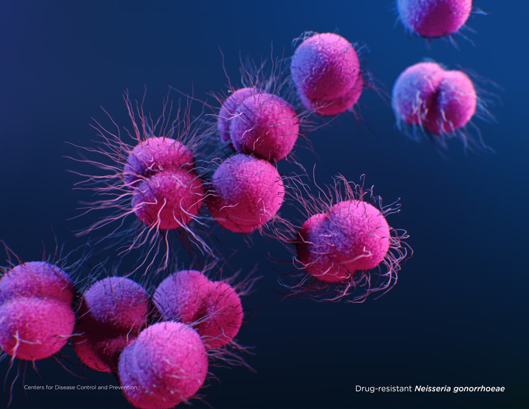Illustration for Drug-resistant Neisseria gonorrhoeae