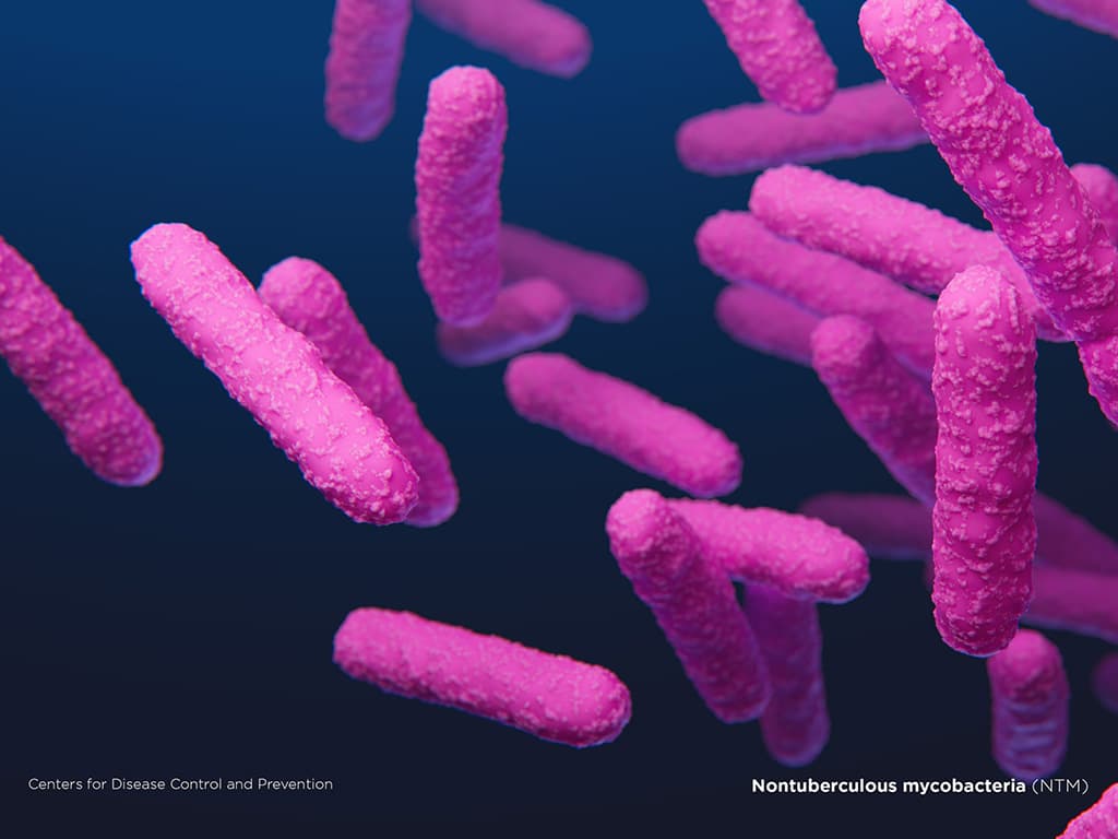 Nontuberculous mycobacteria