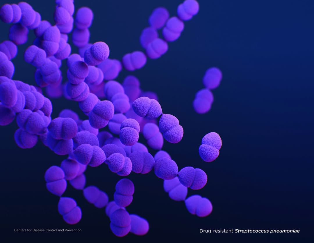 Illustration of Drug-resistant Streptococcus pneumoniae