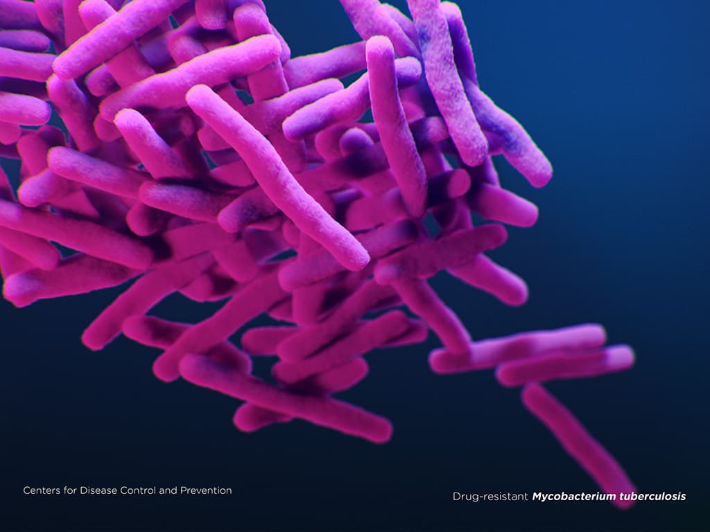 Illustration of Drug-resistant Mycobacterium tuberculosis